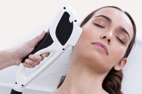 Fotorejuvenecimiento-facial-IPL