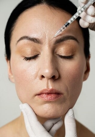 botox entrecejo madrid