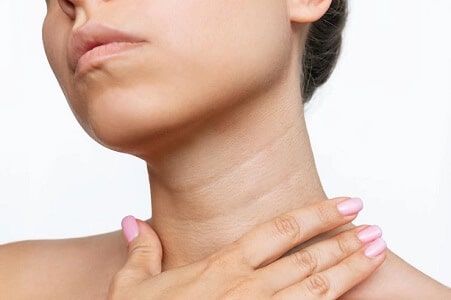 botox para eliminar las arrugas del cuello precio