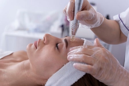 dermapen capilar para el pelo