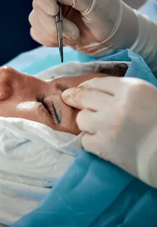 cirujano corte de parpado superior