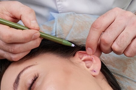 operacion orejas cirugia