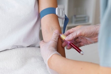 tratamientos esteticos con plasma sanguineo