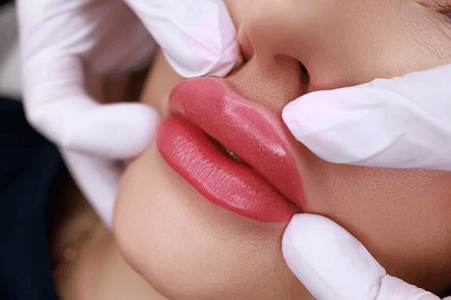 Elevacion del labio superior