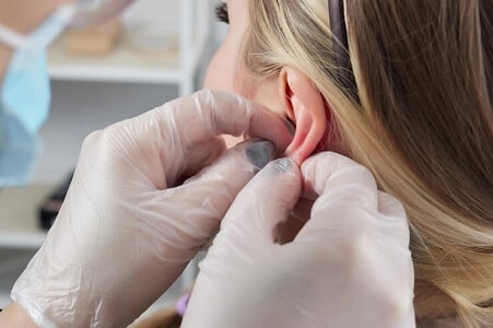 cirugia lobuloplastia madrid