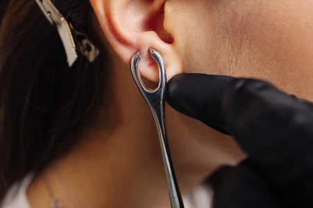 operacion lobulo oreja madrid