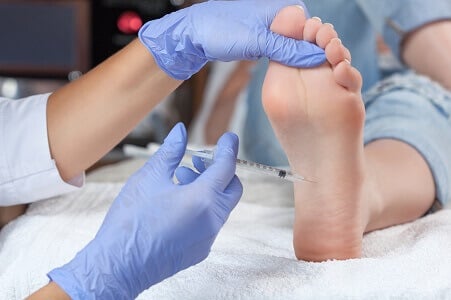 tratamiento sudoracion pies madrid