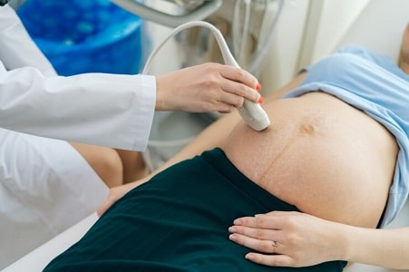 ecografia doppler bebe
