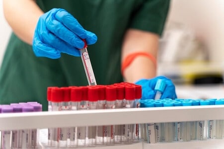 extraccion de sangre para la tiroides