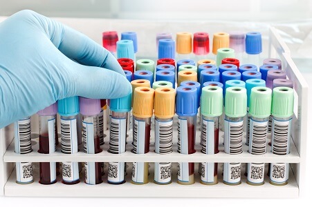 precio extraer sangre para colesterol y trigliceridos