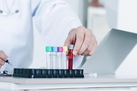 analisis de sangre control endocrino precio