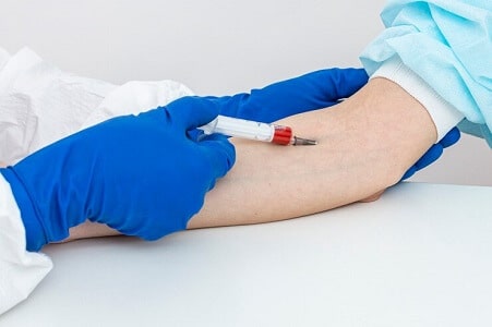 test antigeno prostatico especifico