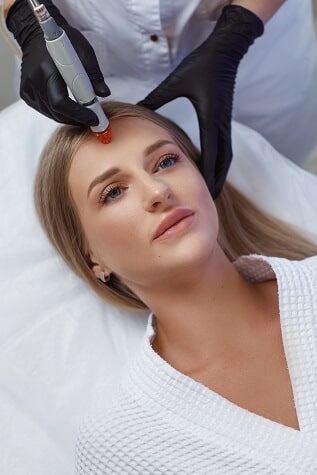 Dermapen con exosomas madrid
