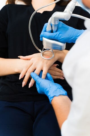 laser co2 para rejuvencer manos