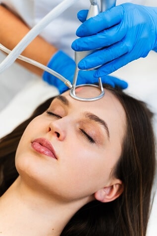 laser co2 periocular y contorno de ojos